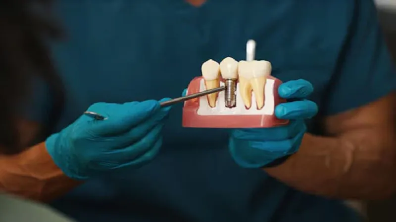 dental implants in Manchester